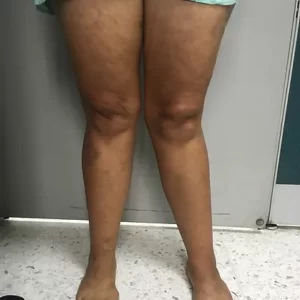 Deformidad Izquierda